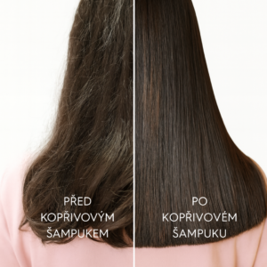 CZ_KOPRIVA