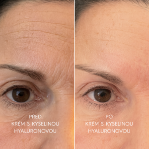 pred a po skin care balicku