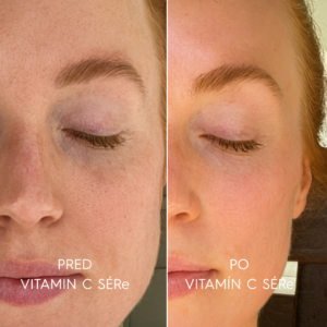 vitamin sk 23